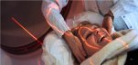 Preparation for CT scanning